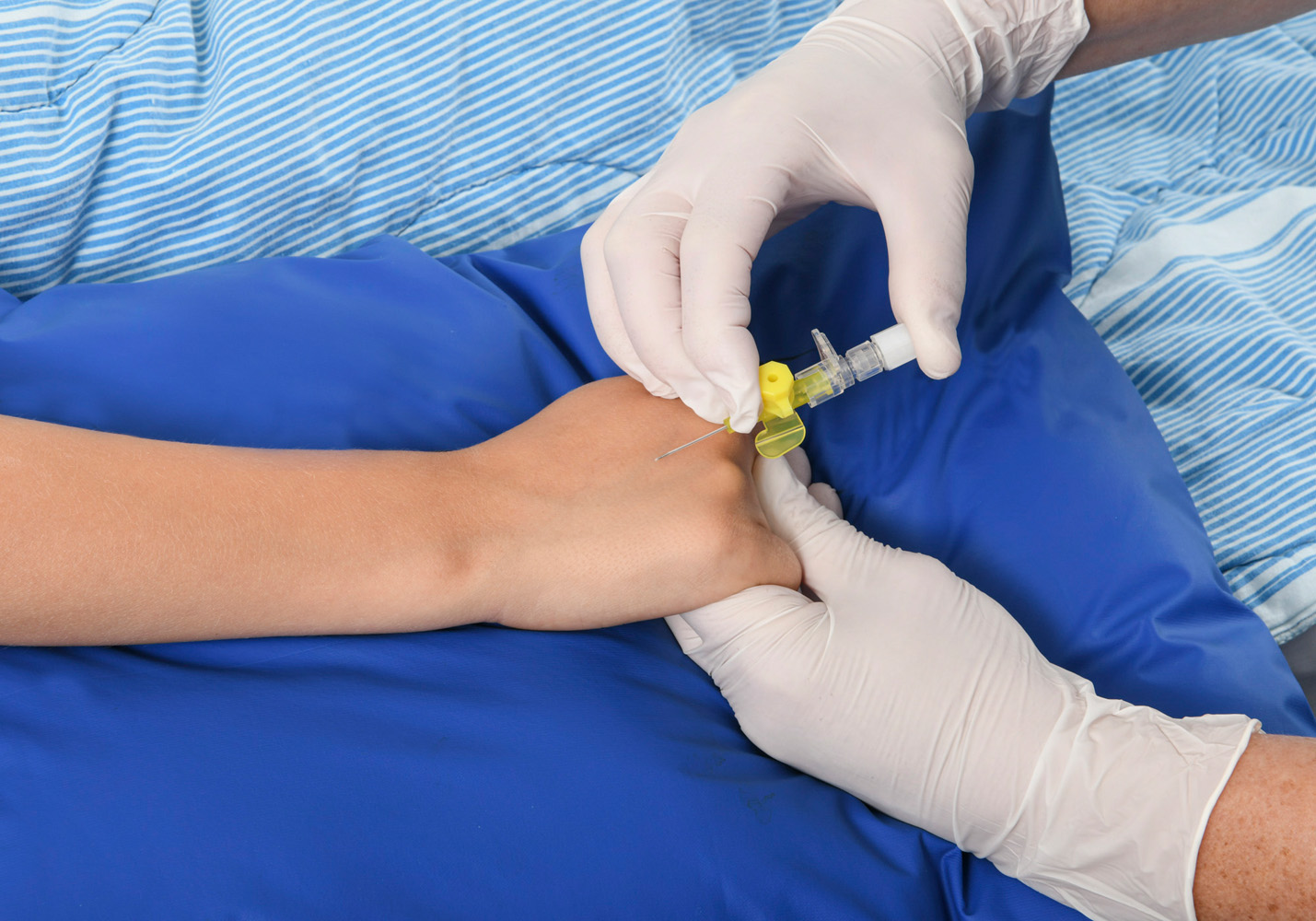Close-up photo of how Lollo inserts the tube in Frank’s hand using a needle.
