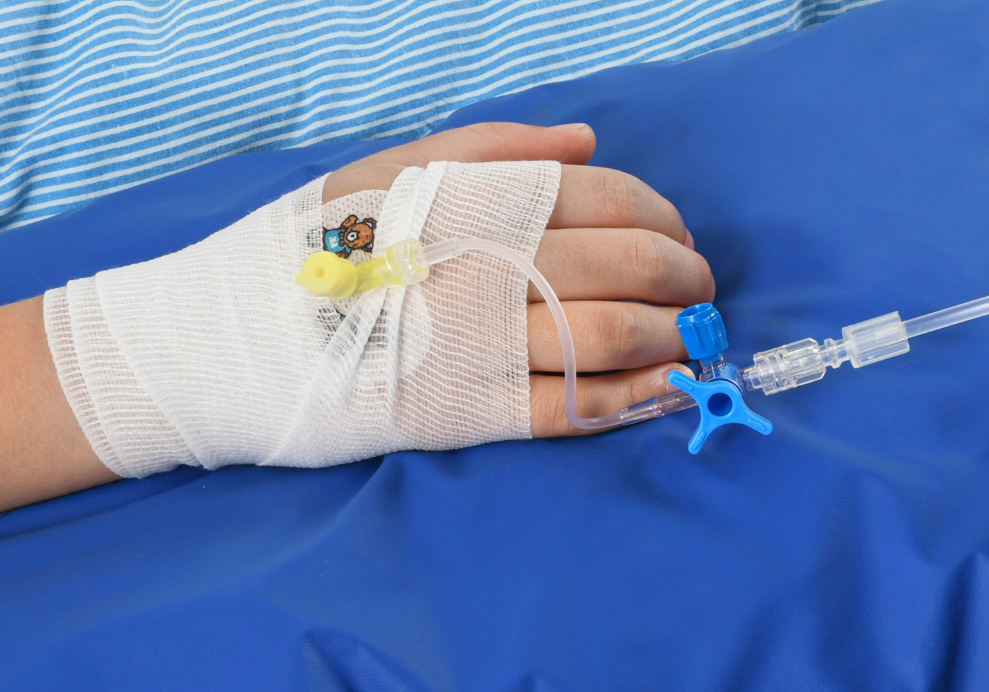 A tube has been connected to the yellow thing on Frank’s hand.
