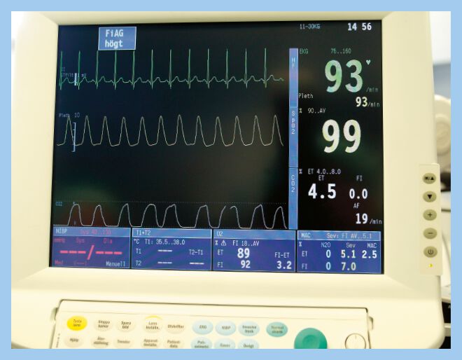 A monitor with several curves in different colours.
