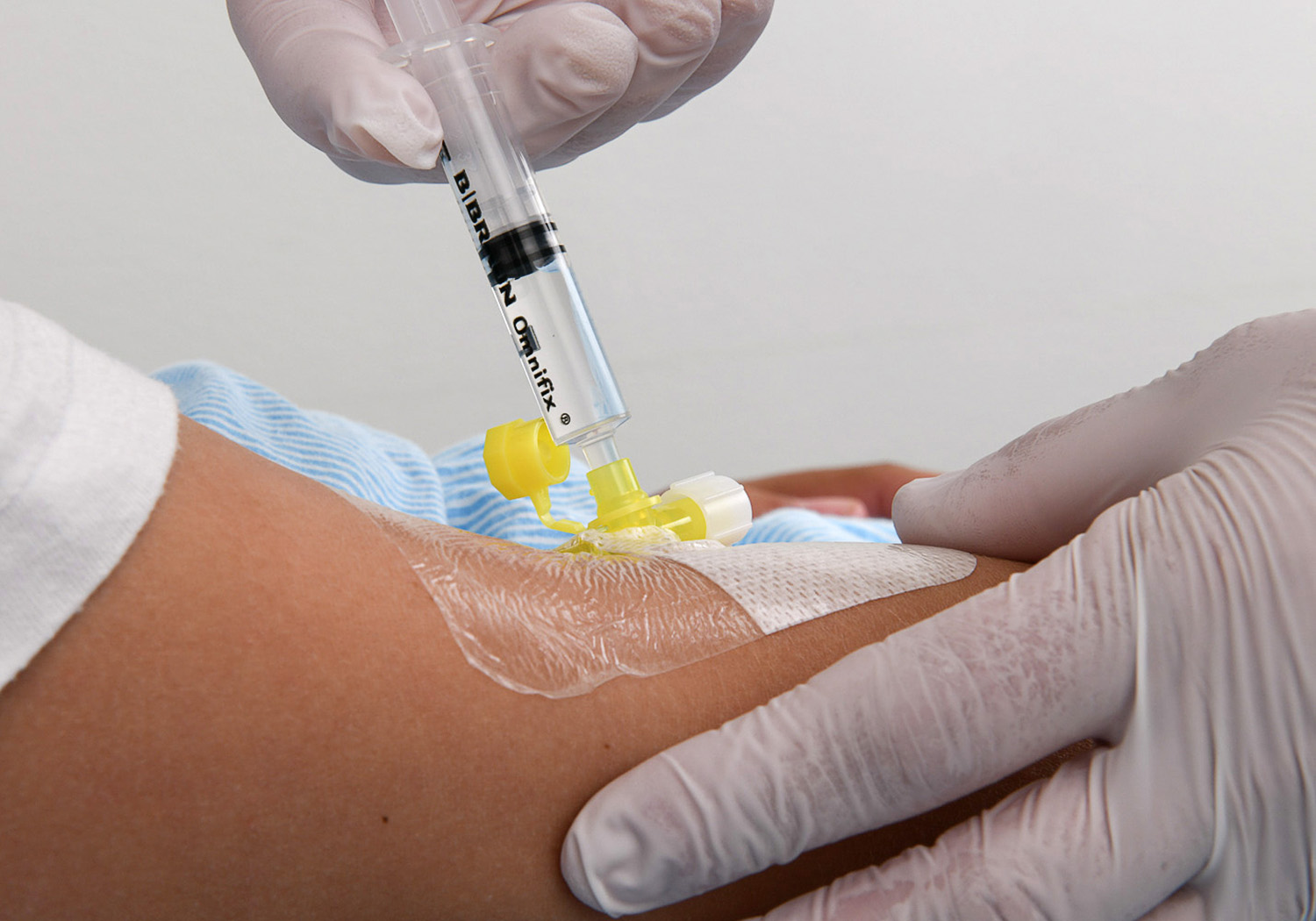 A yellow thing made of plastic, taped to the crook of an arm. A pair of hands wearing gloves, injecting medicine into the yellow thing.