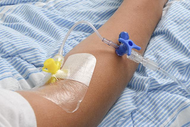 A yellow intravenous access in an arm.